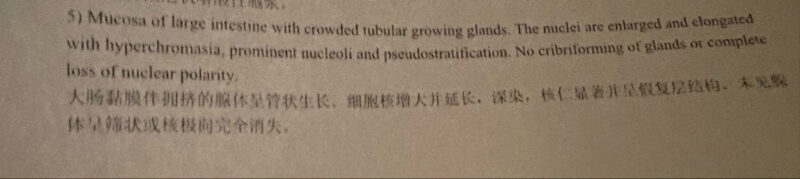 17C6AA2D-8A64-4DE6-B476-6C0E43BCDC79