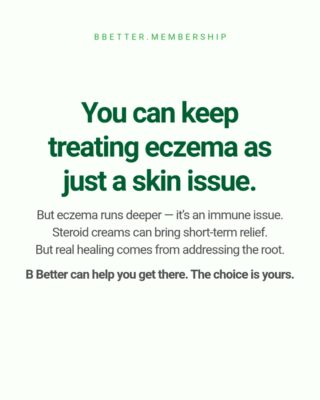 Eczema